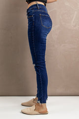Distressed Button Fly Skinny Jeans - Shah S. Sahota